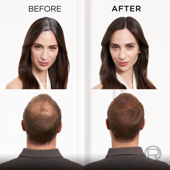 Paris Magic Retouch Instant Root Spray, Dark Brown. Offers Flawless Coverage for Grey Regrowth in 3 Seconds. This 75Ml Spray Provides a Quick, Easy Way to Conceal Roots Perfectly.