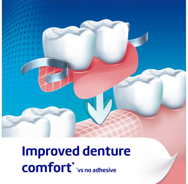 Denture Fixative Adhesive Cream Ultra for Strong All-Day Hold of Dentures, 40G