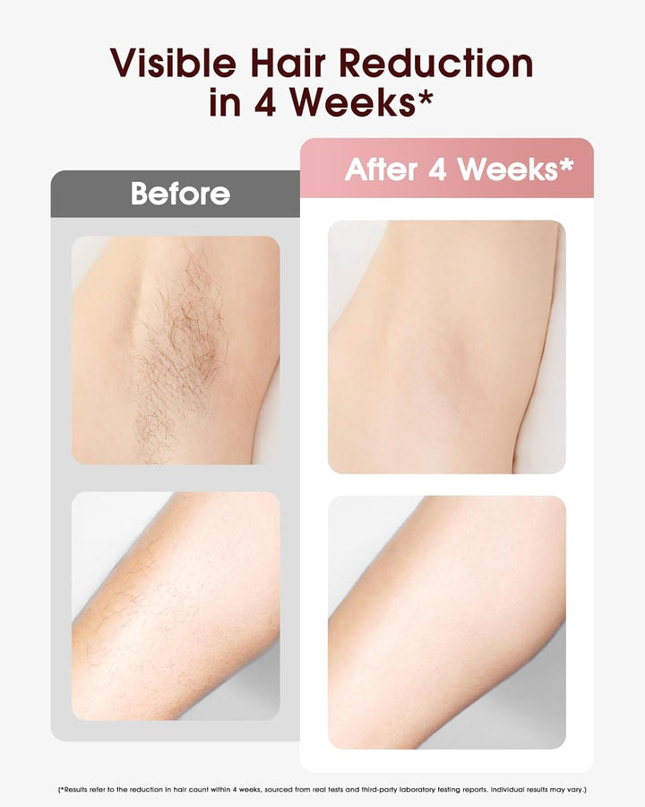 IPL Laser Hair Removal Device for Women and Men, Ice Cooling Painless Hair Remover Machine for Salon Quality Long Lasting Results at Home, for Face, Bikini Line, Armpit, Leg, Body, Pink