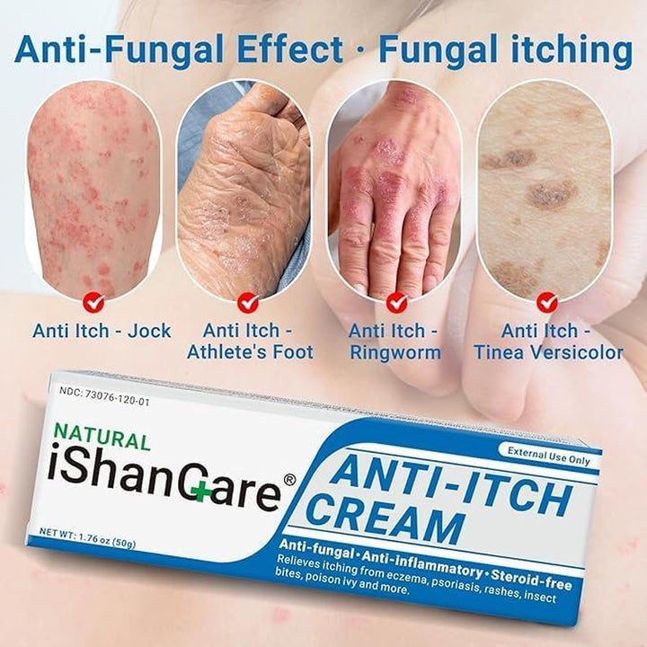 ® anti Itch Cream, Maximum Strength Instant Itch Relief for Rash, Eczema, Bug/Mosquito Bites, Psoriasis, Poison Ivy, Dermatitis, Soothing Moisturizer for Dry, Sensitive Skin