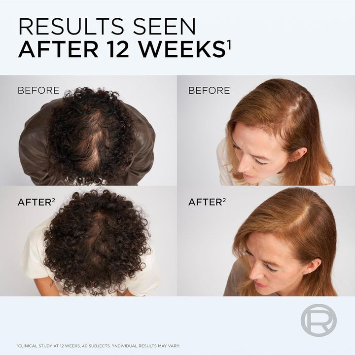 Elvive Growth Booster Scalp Serum, anti Hair Loss Scalp Treatment, with Aminexil, Nianimacide and Ginger Extract, Reduces Hair Loss, 102Ml