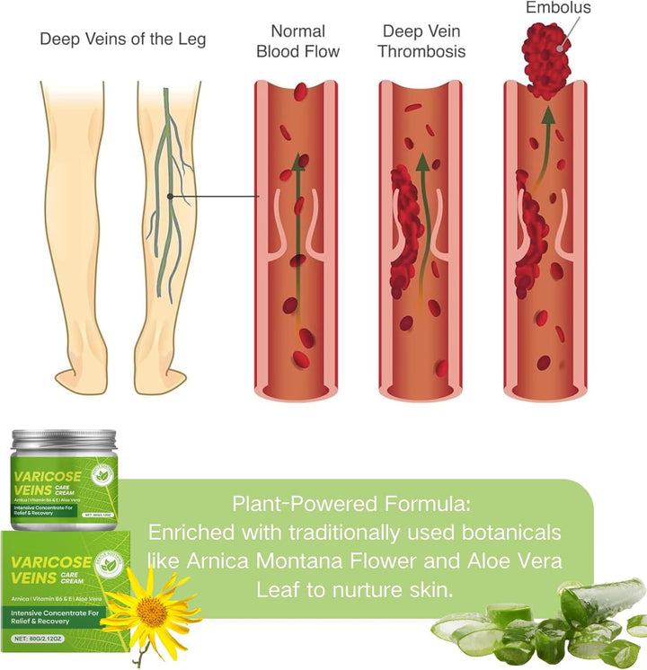 Vari/Cose Veins Cream for Legs - Vari/Cose Veins Leg Care Cream with Vitamin E & Aloe - Reduces Leg Discomfort - Fast-Absorbing, Non-Greasy - 60G
