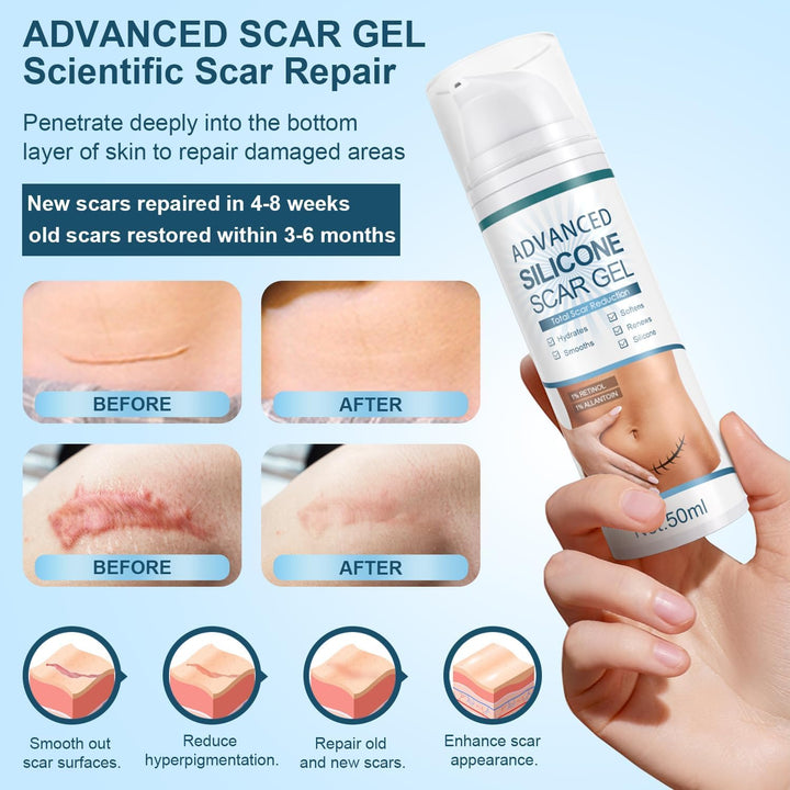 Advanced Silicone Scar Gel, Effective Scar Cream - Reduces the Appearance of Both Old and New Scars from Burns, Injury, Acne, Stretch Marks, Keloid, C-Section, and More, 1.7 Oz