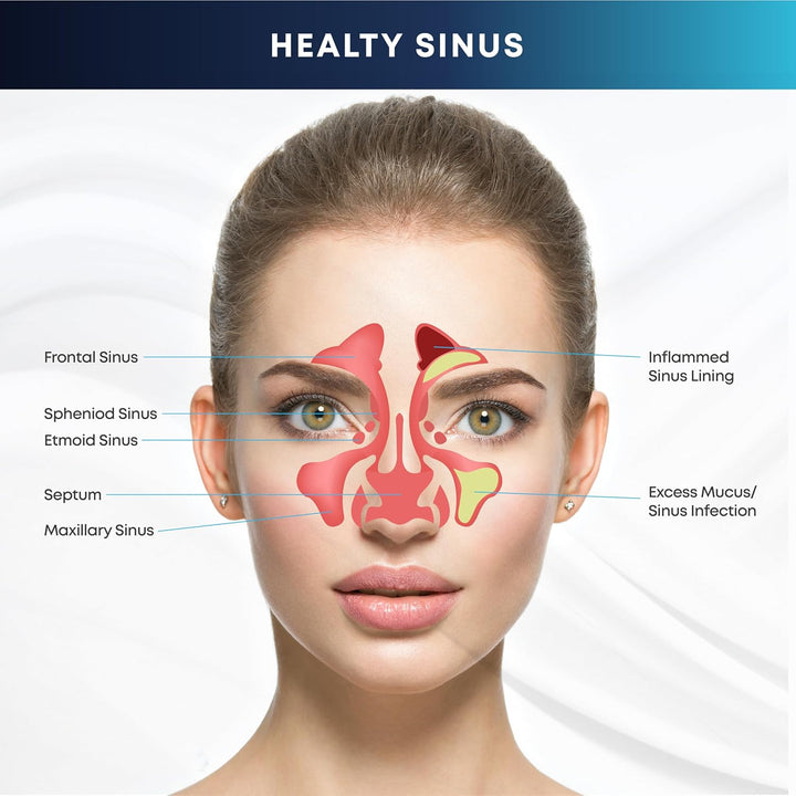 Nasal Rinse Kit – 300Ml Bottle + 20 Saline Packets – Neti Pot for Sinus Relief & Nasal Hygiene – PH Balanced, Drug-Free, Preservative-Free – Suitable for Adults & Children 5+