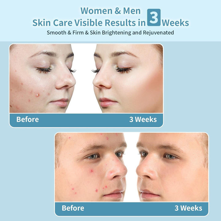 Laser Hair Removal Device, 3 in 1 Beauty Salon Grade Home Hair Remover Device with Cooling System, IPL Body Painless Laser Hair Removal for Face Armpits Arms Legs Bikini Line