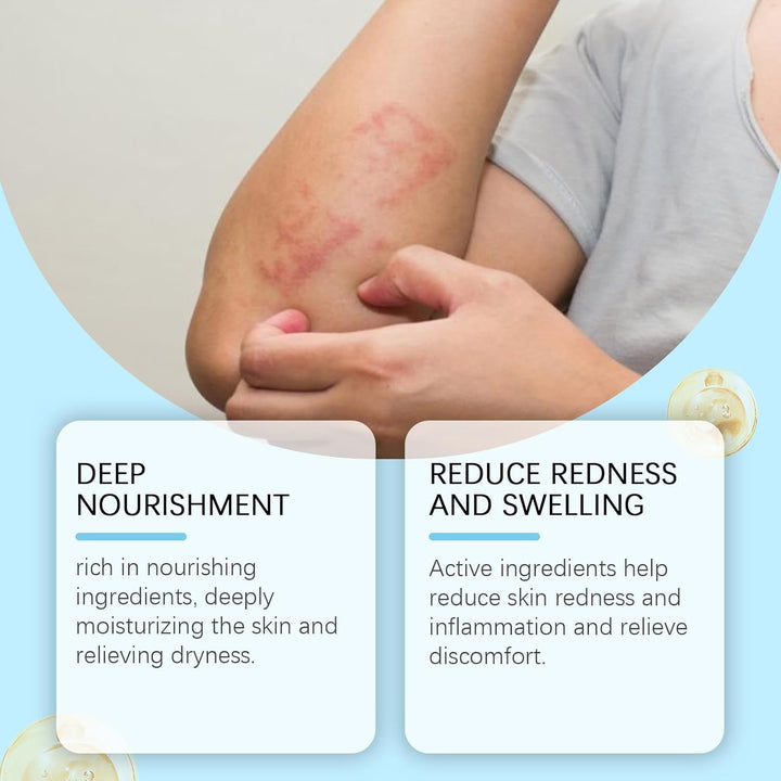 Antifungal Cream - anti Fungal Skin Cream - Ringworm, Jock Itch, Eczema, Tinea Versicolor, Athletes Foot Treatment - Fast Acting & Gentle Safe & Soothing Hydrating Formula