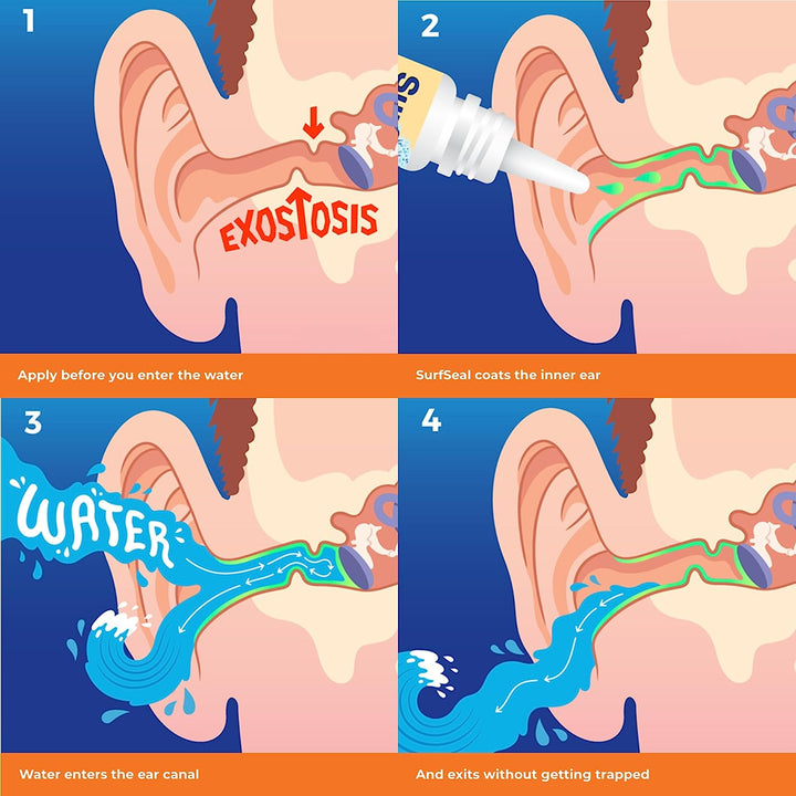 All Natural Swimmer'S Ear Drops for Daily Use Rather than Alcohol Drops or Earplugs. the Solution for Your Ears for All Water Exposure for All Ages.