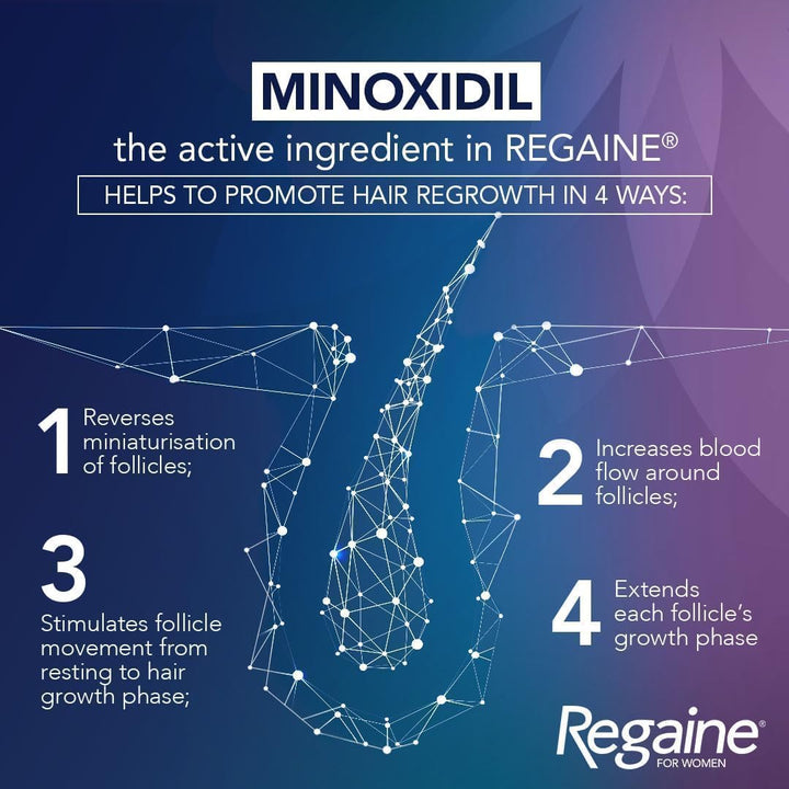 for Women 2% Minoxidil Regular Strength Scalp Solution for Hair Regrowth (1X 60 Ml), Scientifically Proven to Help Stop and Reverse Hereditary Female Hair Loss, Revitalise Hair Follicles