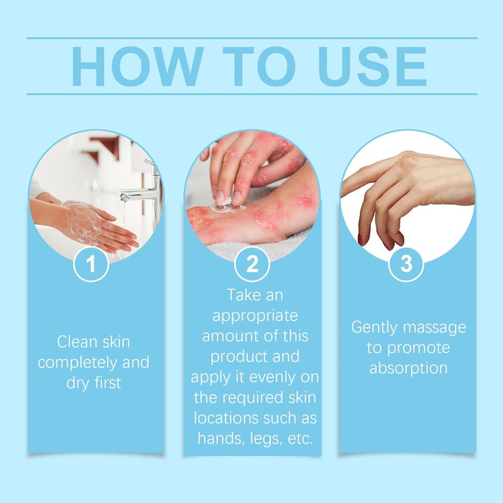 Antifungal Cream - anti Fungal Skin Cream - Ringworm, Jock Itch, Eczema, Tinea Versicolor, Athletes Foot Treatment - Fast Acting & Gentle Safe & Soothing Hydrating Formula