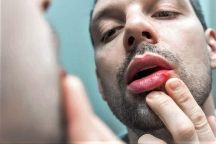 Tea Tree Ointment for Dry Skin, Handmade, Natural Beeswax, Tea Tree Balm, Vitamin E, Sweet Almond Oil, Salve for Cuts, Burns, Insect Bites, Soothing Skin Moisturiser with Sunflower Oil (60Ml)