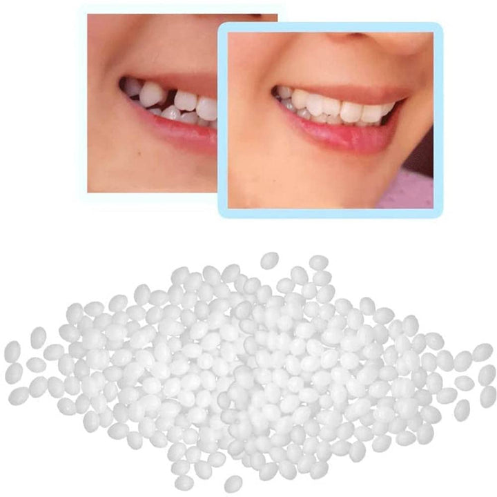 Temporary Tooth Repair Kits,Dental Repair Denture Repair Beads for Temporary Fixing Filling Missing Broken Tooth Moldable Fake Teeth