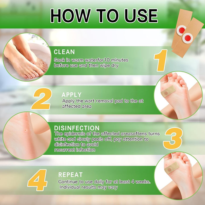 Wart Remover, 30Pcs Verruca Treatment, Plantar Wart Remover for Hands, Feet, Effective Deep Verruca Removal Pads Patches, Pain Relief, Non-Irritating Wart Treatment for Adults