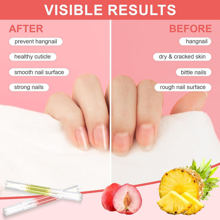 Cuticle Oil Pen,3Pcs Nutrition Oil Pen with Nail File,Cuticle Oil for Nails with Natural Ingredients,Nail Oil Cuticle for Repairing Cracked and Dry Nail(Pineapple & Peach & Jasmine Flavor)