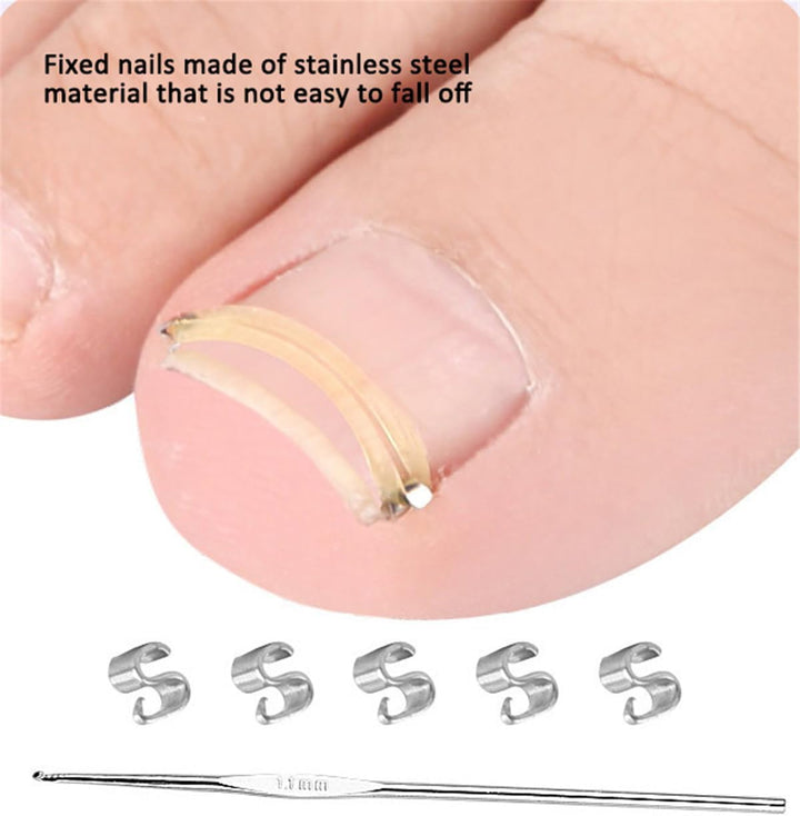 Ingrown Toenail Corrector, Stainless Steel Curved Toenail Straightener with Rubber Bands, Ingrown Toenail Removal Kit, Professional Ingrown Toenail Pedicure Tools for Men Women Curved Nail Repair
