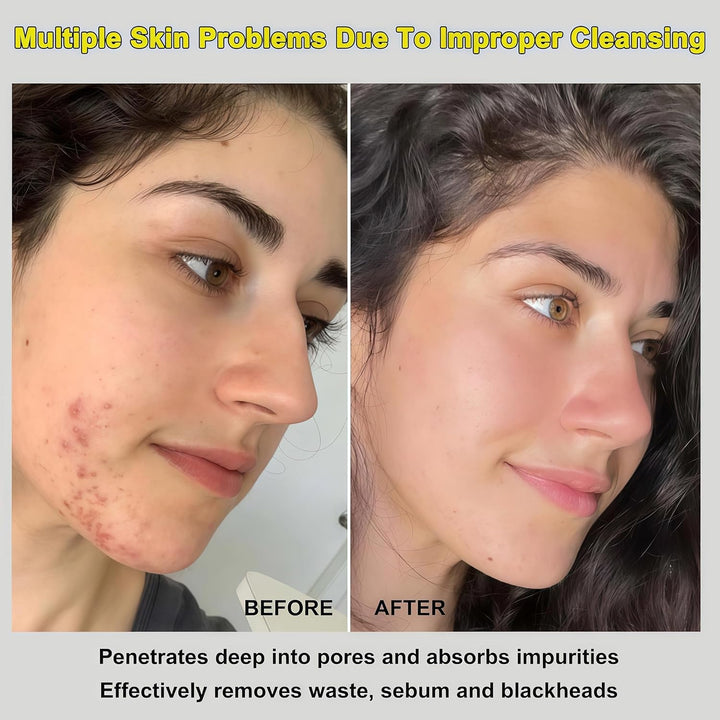 ANGEL SILK 2Pack Recovery & Relief Mud Mask, Boryeong Mud, Korean Face Mask, Natural K Beauty Deep Pore Cleaner for Hard Water & Oily Skin, Glass Skin Hydrating Face & Body Mask