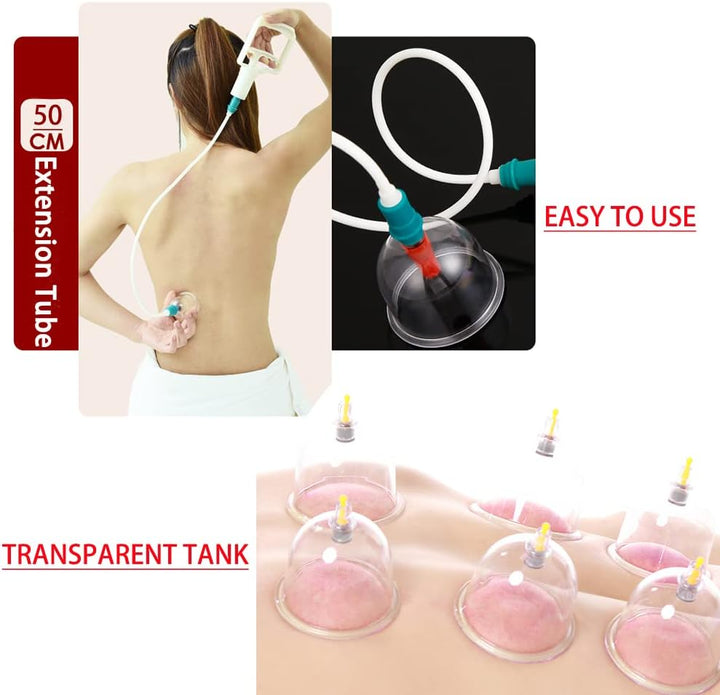 26 Cupping Cups Sets Biomagnetic Traditional Professional Chinese Therapy Massage Vacuum Cupping Set Household Pull Out Cupping Kit/Hijama Chinese Massage Suction