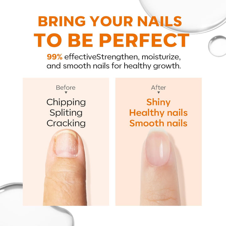 Nail Care 8 in One Ridge Filling Strengthener Treatment, Nail Polish Strengthener for Damaged and Weak Nails, Nail Hardener Extra Strong and Growth Smoothing Base Coat Clear Varnish 15Ml