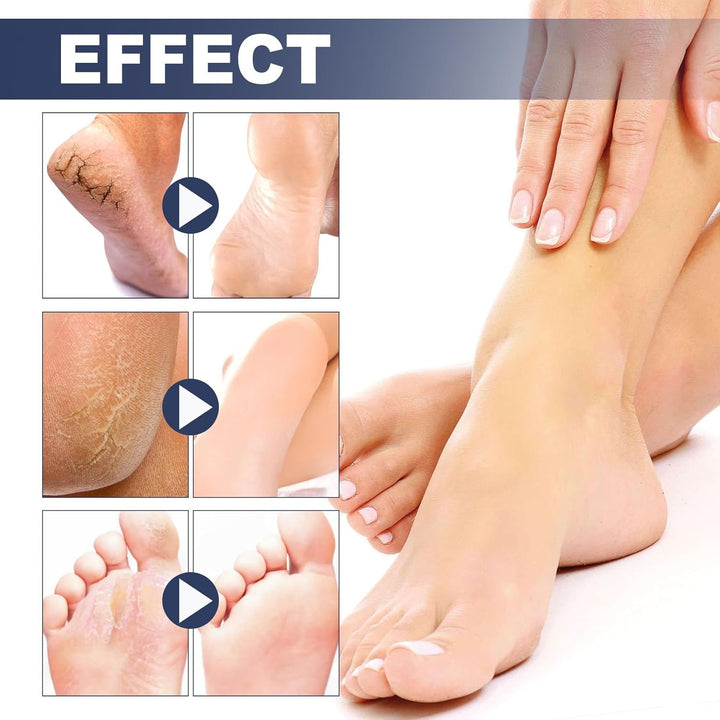 2PCS Athletes Foot Treatment,Anti Fungal Skin Cream,Antifungal Cream for Effective Anti-Itch,Itch Relief Cream,Foot Fungus Treatment,Itchy Skin Relief for Adults,Athletes Foot Cream Extra Strong