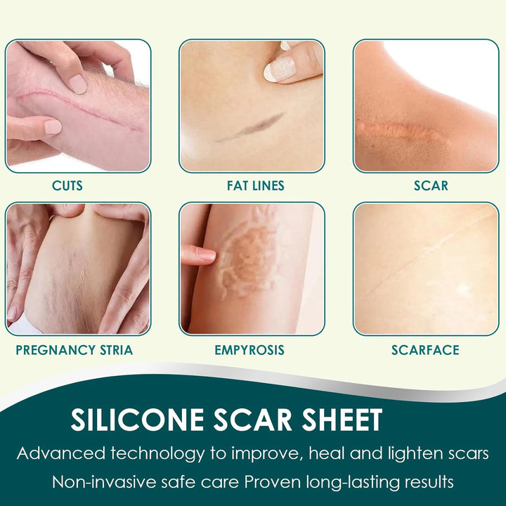 Silicone Scar Sheets, Premium Silicone Gel Scar Tape, Reusable Silicone Patches, Painless Silicone Tape Roll, Silicone Scar Tape for Surgeries Scars, C-Sections, 1.6'' X 120''Roll-3M
