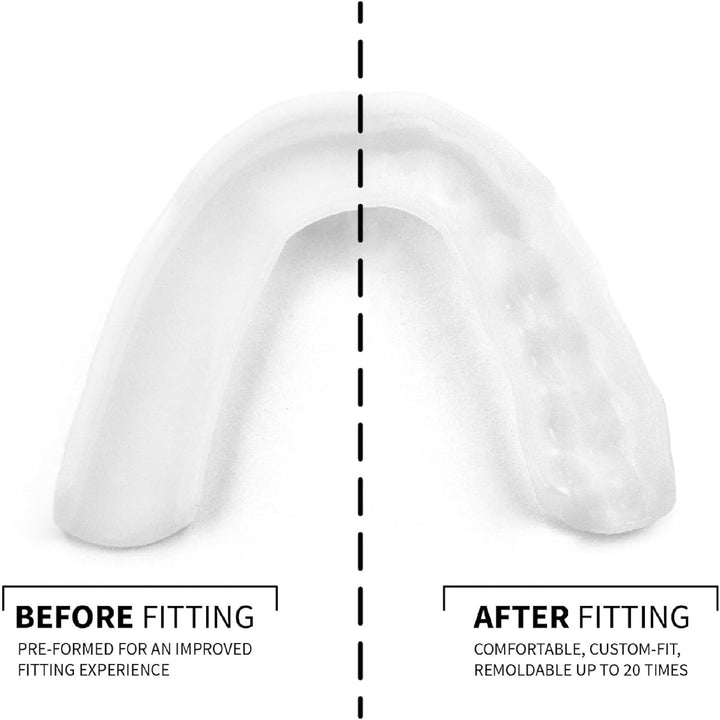 1.6Mm Mouth Guard for Clenching and Grinding Teeth at Night, Custom-Fit Sleep Night Guard with Case (3DN-CASE-E)