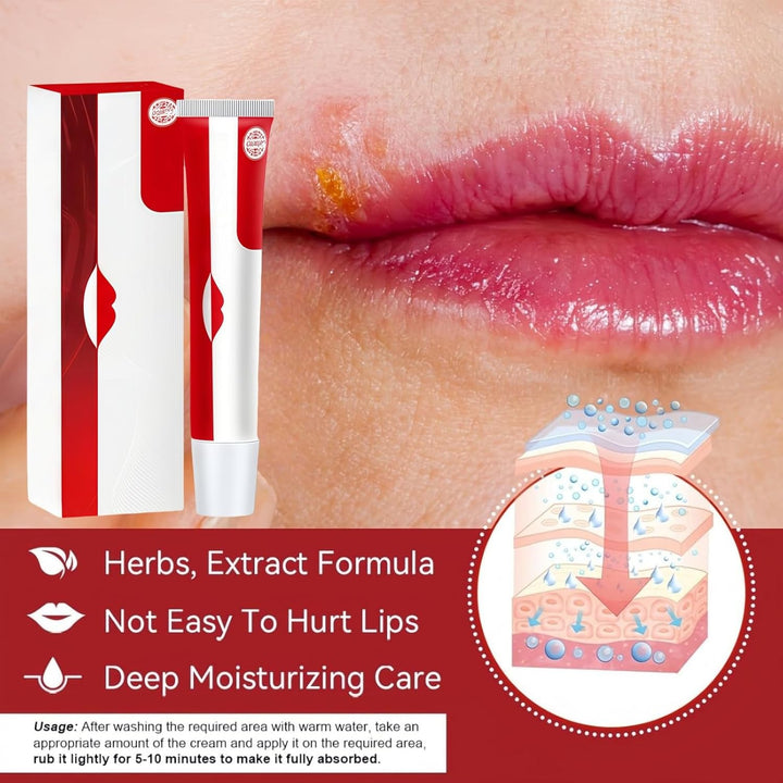 Cold Sore Cream,Gentle Cold Sore Treatment Cream,Mouth Ulcer Treatment for Adults,Gentle Sore Lips Treatment,Mouth Sore Treatment for Women and Men,Mouth Ulcer Gel,Pain Relief,Natural Ingredients