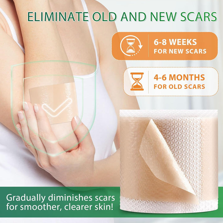 Silicone Scar Tape, Medical Grade Silicone Scar Sheets (1.6" X 75"-1.9M), Professional Scar Removal Treatment, Reusable Scar Tape for Healing Keloids, Surgeries Scars, C-Sections and Burns
