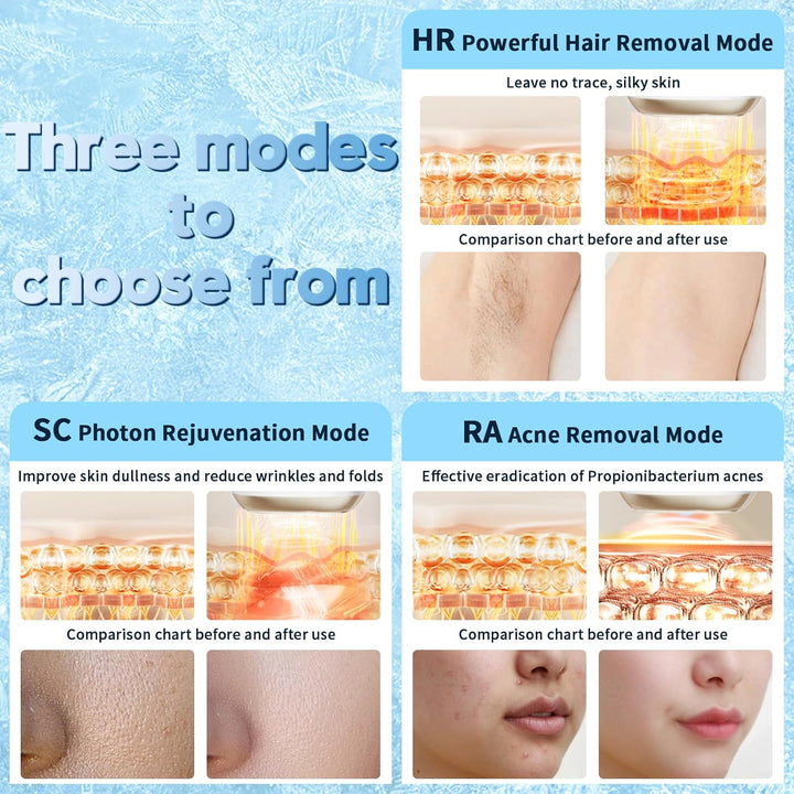 IPL Laser Hair Removal Device with HR/SC/RA 3-In-1 Function, Faster, Salon Quality Result, at Home IPL Laser Hair Remover Machine for Women and Men, Face, Bikini Line, Body, Leg, Armpit, 9 Level