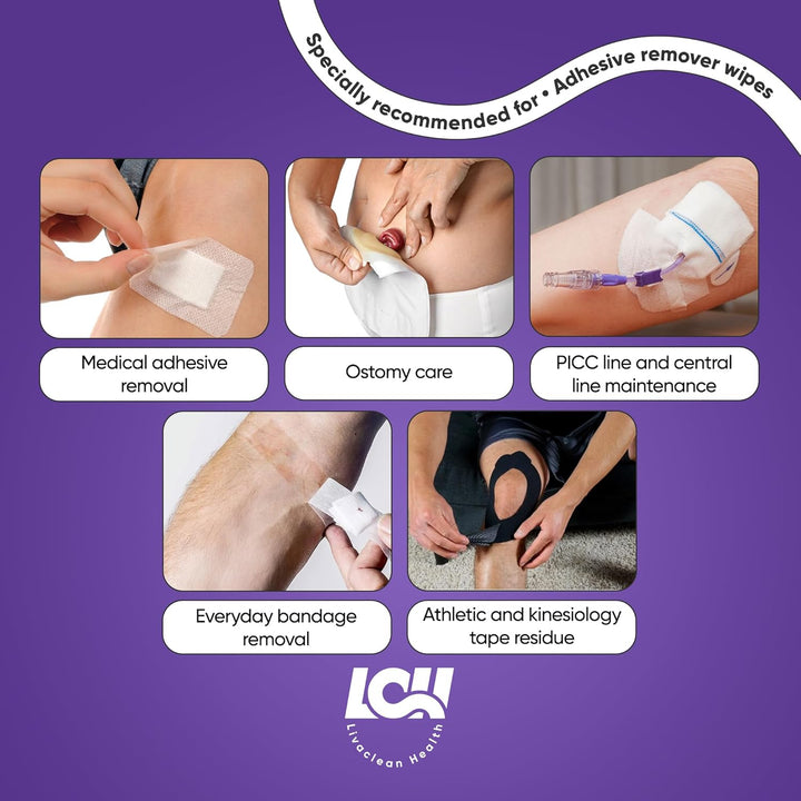Adhesive Remover Wipes for Skin 100 CT – Medical Adhesive Remover for Tape, Plaster & Sticky Residue – Individually Wrapped, Non-Greasy 2-Ply 2.56X1.18In (6.5X3Cm) Skin Wipes