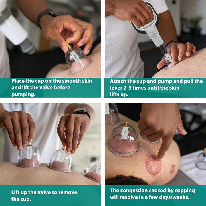 Professional Cupping Therapy Set, 24 PCS Suction Cups with Pumping Handle, Chinese Cupping Set, anti Cellulite Cupping Massage for Body and Face, Relief Muscle Tension Pain