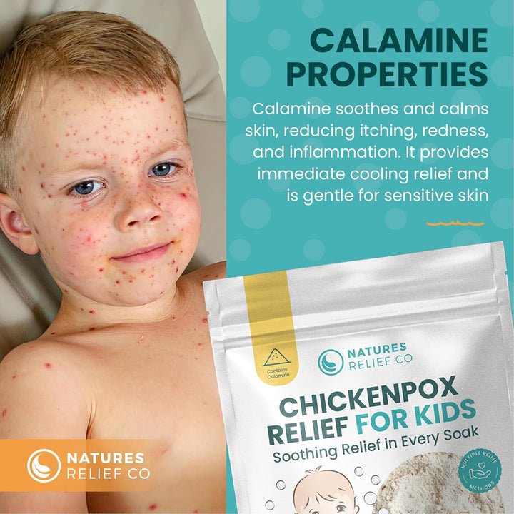 Chickenpox Relief Treatment | Colloidal Oatmeal & Calamine | Oatmeal Bath Soak for Chicken Pox Relief Kids - Colloidal Oatmeal Bath for Itchy Skin and Pain Relief | Made in UK | 300G