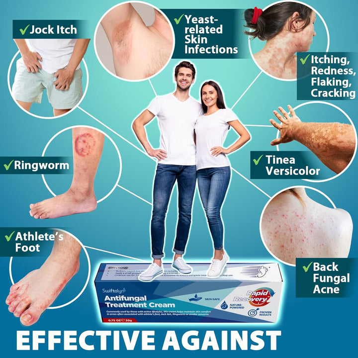 Antifungal Treatment Cream for Skin: Natural Herbal Formula for Skin Prone to Athlete’S Foot, Ringworm, Jock Itch & Foot Fungus – Daily Use for Men & Women