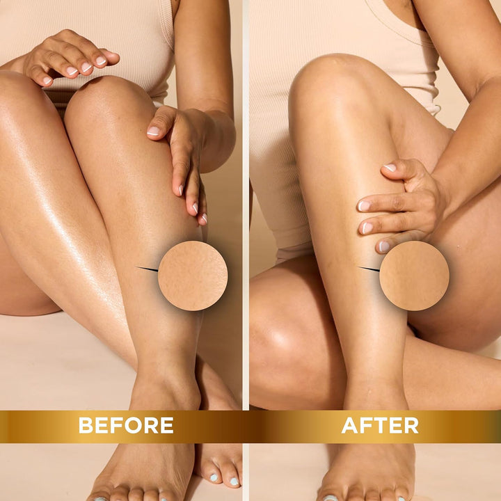 Magic Smooth Razorless Hair-Removing Cream 6Oz/170G