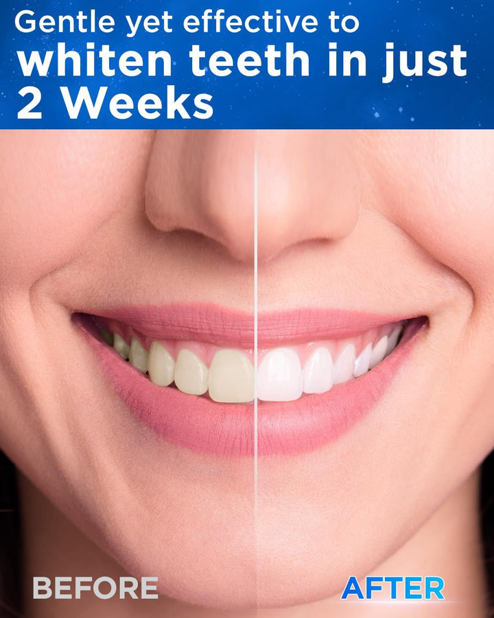 Sonic Electric Toothbrush for Adults and Kids - Sonic Toothbrush with 8 Toothbrush Heads (3 Types) and 5 Modes, 120 Days Battery Life, 50000 VPM, Travel Case and Wall Holder, 2 Minute Timer, USB C