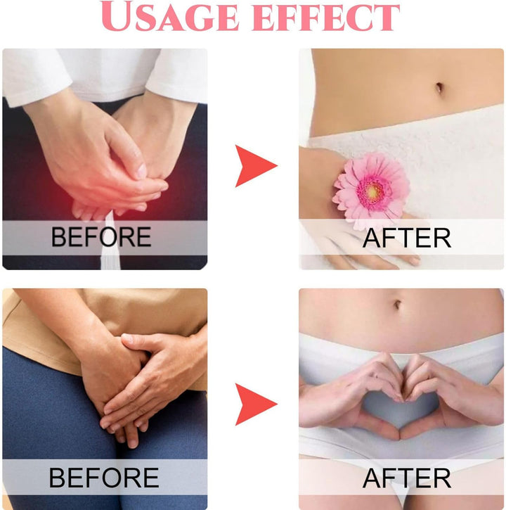 Bladder Control Patch,Bladder Patch,Bladder Health Pa-Tch,Control Pa-Tch,Women Uri-Ne Lea-Kage Pa-Tch,Go to Toilet Less Frequently,Blad-Der Support,Body Care Patc-Hes,Pain Relief