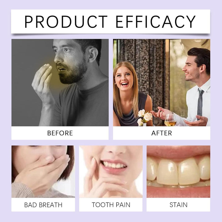 Pro-Biotic Oral Spray,Pro-Biotic Breath Spray,Mouth Spray,Breath Freshener Spray,Bad Breath Treatment for Adults,Fresh Breath Spray for Bad Breath,Long-Lasting Mouth Freshener Spray,Dry Mouth Spray