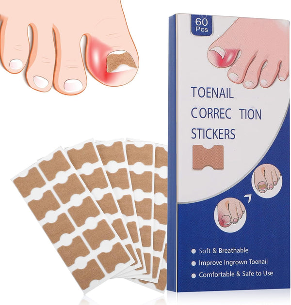 60Pcs Ingrown Toenail Treatment Patches-Ingrown Toenail Corrector Strips, Durable Toe Spacers, Quick Repair Ingrown Nail Tool for Women Men