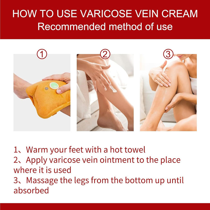 Cream for Varicose Veins in Legs,Varicose Veins Cream,Vein Relief Cream,Vein Cream for Legs,Varicose Veins Treatment Cream,Varicose Vein Removal Cream,Improve Blood Circulation,20G,1Pc