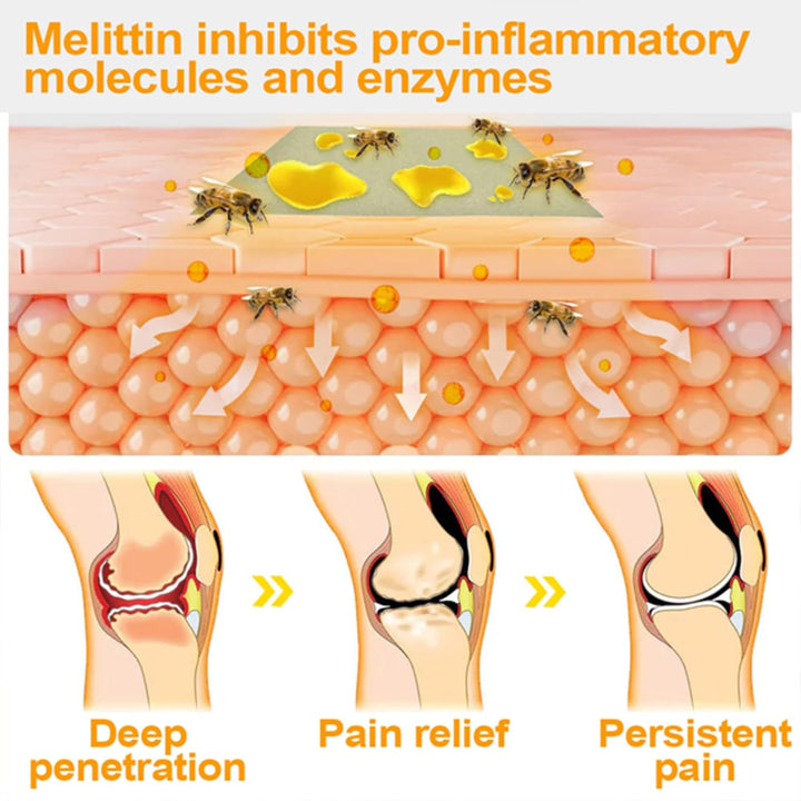 Turonu Bee Venom Treatment Cream, Professional Joint & Bone Therapy Crem,Turonu Bee Venom Repair Cream for All Skin Types (1)