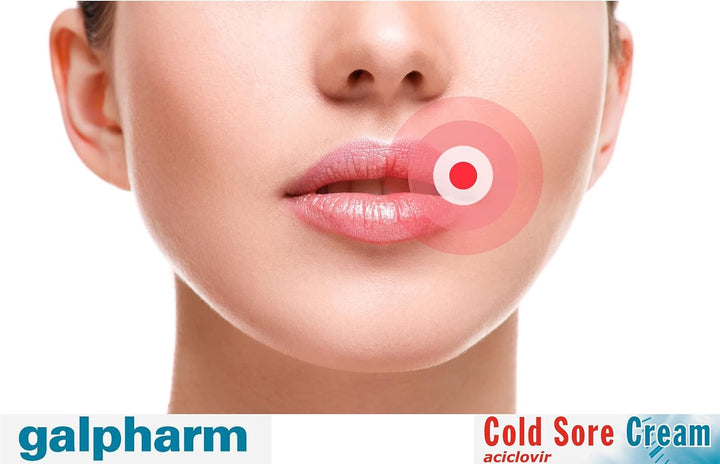 Cold Sore Cream 2G X 3 Packs