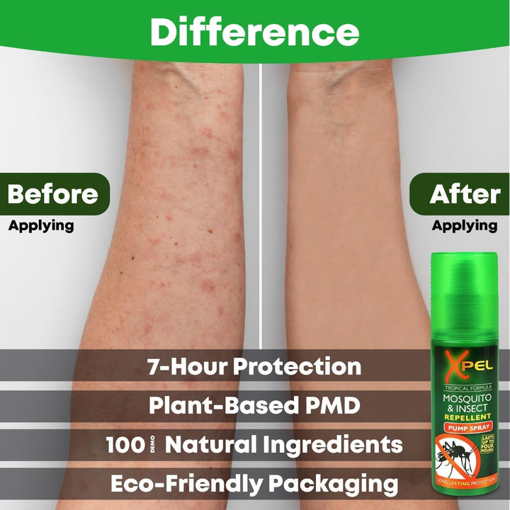 Mosquito & Insect Repellent Spray (2 Pack) + after Bite Pen – Tropical Formula for Bite & Sting Relief – Fast-Acting, Anti-Itch, Soothing, Cooling – Travel Size 3-Pack Bundle