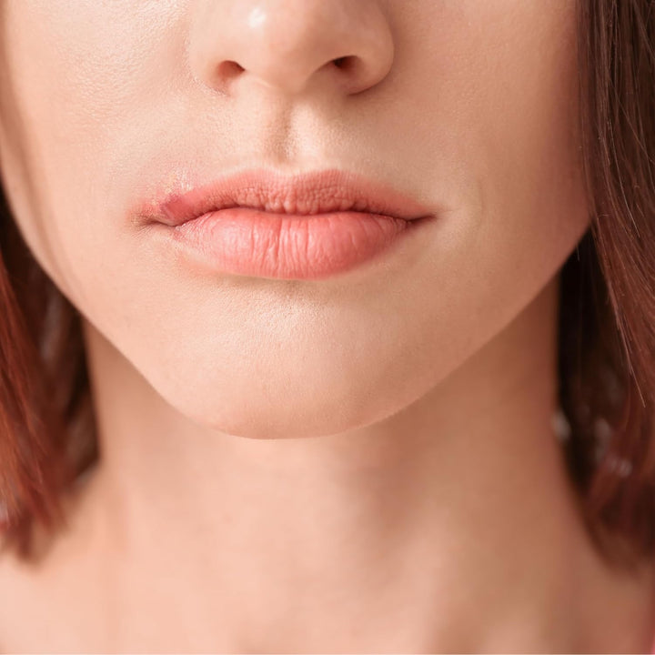 3 X 2G 5% Cold Sore Relief Cream (3 Packs) - Effective Treatment - TDY Bundle Including Cold Sore Care & Prevention Guide