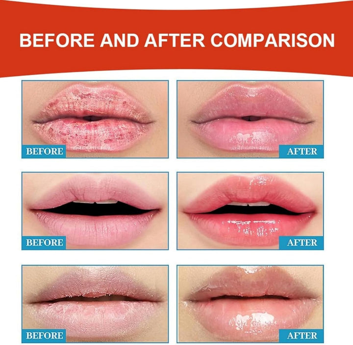 Cold Sore Cream,Gentle Cold Sore Treatment Cream,Mouth Ulcer Treatment for Adults,Gentle Sore Lips Treatment,Mouth Sore Treatment for Women and Men,Mouth Ulcer Gel,Pain Relief,Natural Ingredients