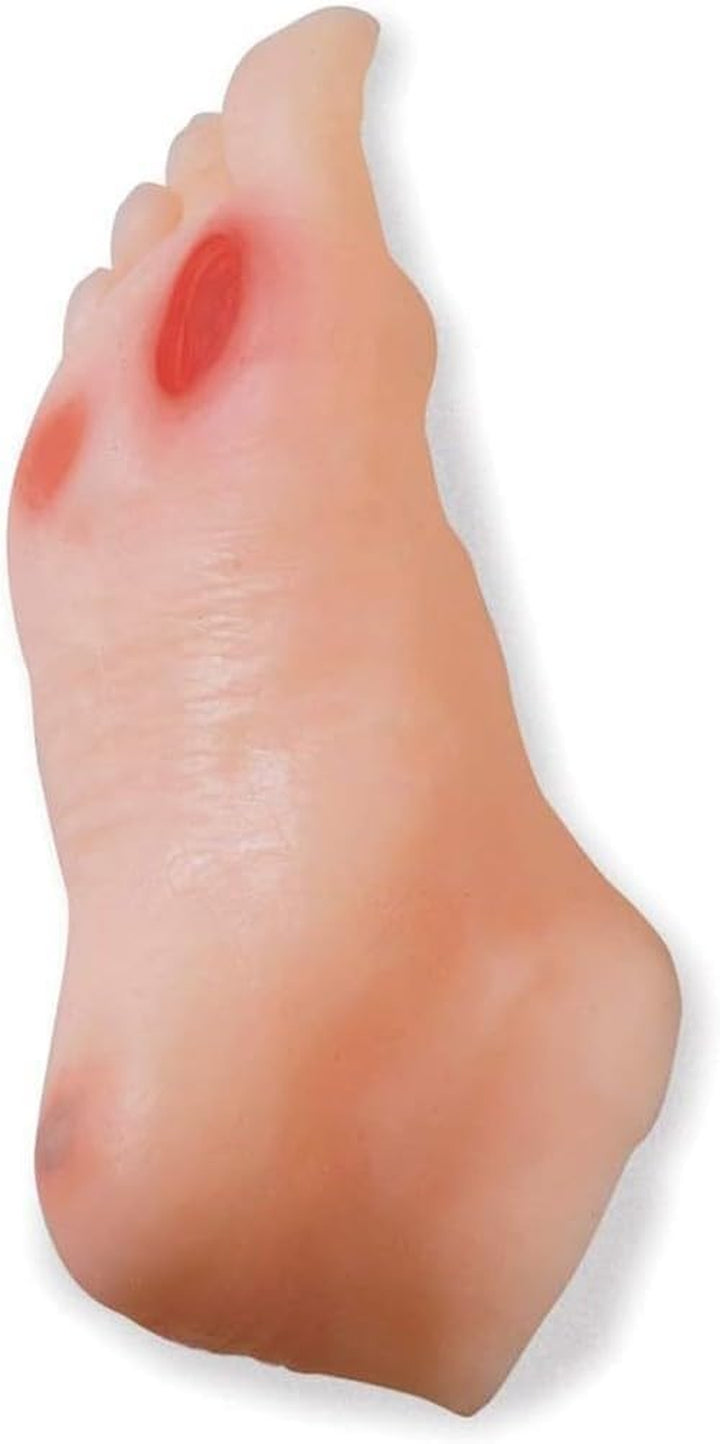 Diabetic Foot Model, Geriatric Nursing Model - Contains 3 Ulcers, for Patient Education and Student Training
