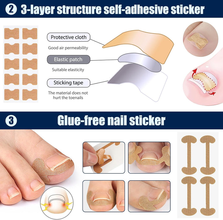 Ingrown Toenail Removal Kit Ingrown Toenail Treatment Tool Kit Ingrown Toenail Corrector Tools with Toenail Braces, Podiatry Tools, Ingrown Toenail Corrector Strips and Patch for Toe Pain Relief