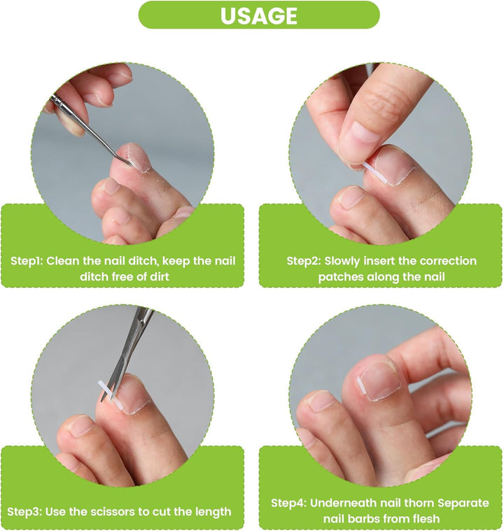 Ingrown Toenail Corrector Set - 40 Pcs Pain-Free Toenail Straightener Strips with Toenail Lifter - Easy Use Ingrown Toenail Tools Kit