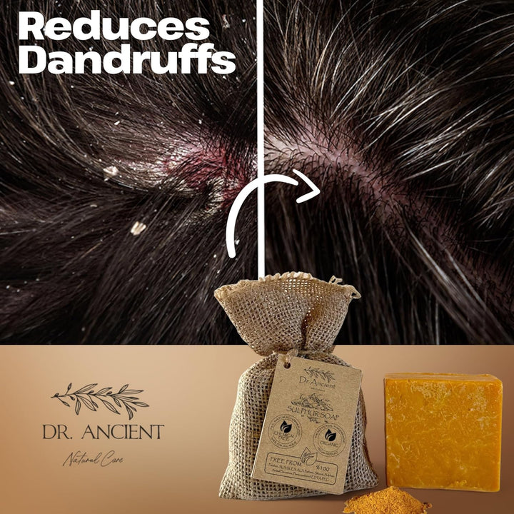 Sulphur Soap Bar, Best Sulfur Soap for Acne, Traditional Soaps for Oily Skin & Hair, anti Bacterial Sulfur Acne Treatment, Organic, Vegan, Pure Natural Handmade Acne Soaps