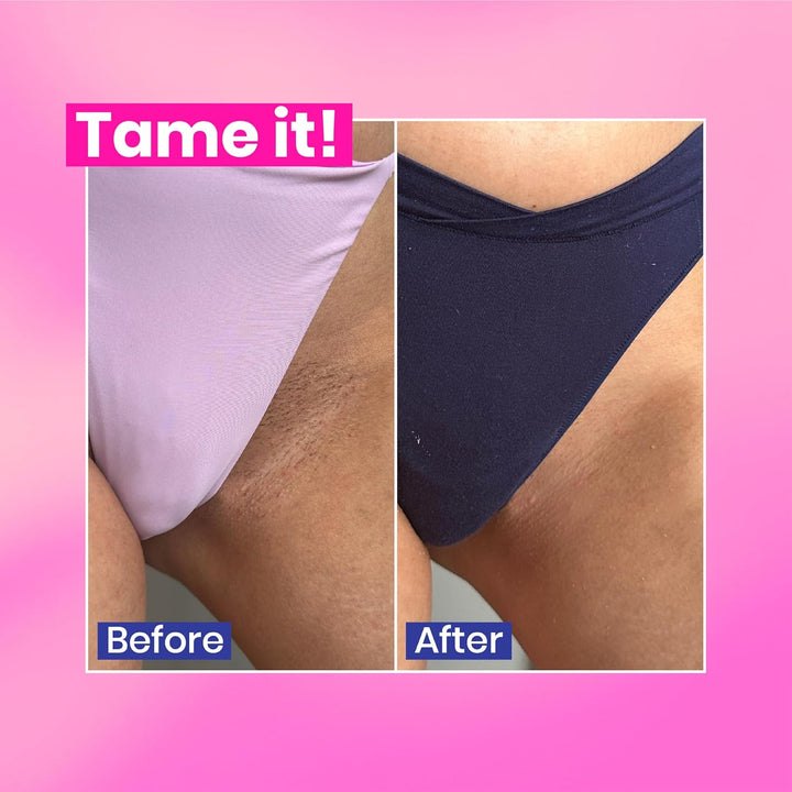 Tame It! Natural Intimate Hair Removal Cream - Painless Vegan Hair Remover for Sensitive Skin - Depilatory for Genitals, Bikini, Legs & Bum - Women In-Shower Cream with Aloe Vera - 100Ml