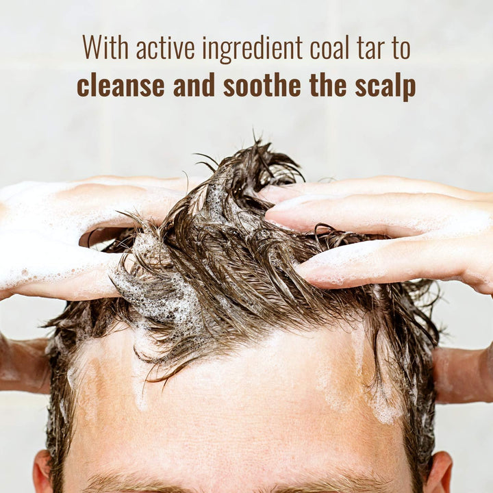 Scalp Shampoo, for Scalp Conditions, Reduces Itching, Inflammation and Scales, Shampoo Treats Psoriasis, Seborrhoeic Dermatitis, Eczema and Dandruff, Contains Coal Tar Solution, 1 X 150Ml