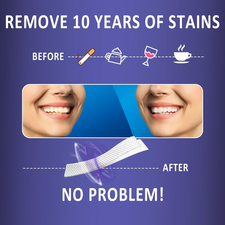 Teeth Whitening Strips 14 Treatments, Non-Sensitive Formula, Non-Slip 28 Whitening Strips for Sensitive Teeth, Fast Whitening, Safe Whitener for Smokers, Coffee Drinkers, Yellow Stains