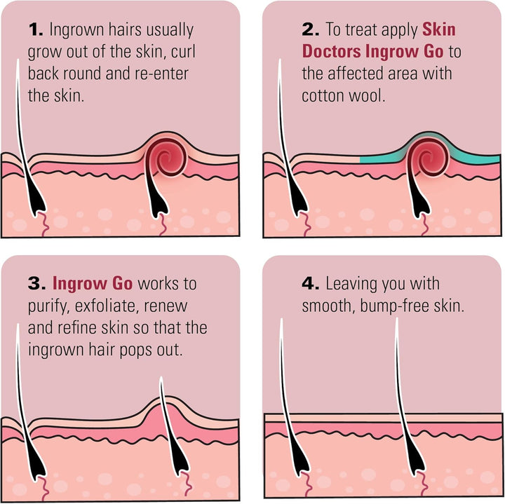 Ingrow Go Lotion | Ingrown Hair Treatment | Reduces Razor Burns & Bumps I Use on Legs, Bikini Line, Underarm & Face | 120Ml